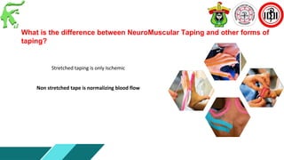 Taping Forms dr. Wahida Ratnawati, Sp.N, M.Kes, FIN. NMTC.Tc.Neu-introduction NMT ...