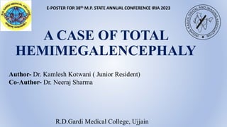 A CASE OF TOTAL
HEMIMEGALENCEPHALY
E-POSTER FOR 38th M.P. STATE ANNUAL CONFERENCE IRIA 2023
Author- Dr. Kamlesh Kotwani ( Junior Resident)
Co-Author- Dr. Neeraj Sharma
R.D.Gardi Medical College, Ujjain
 