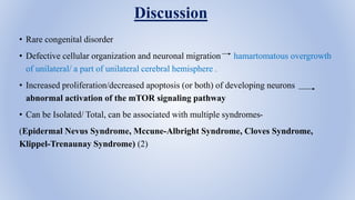 Discussion
• Rare congenital disorder
• Defective cellular organization and neuronal migration hamartomatous overgrowth
of...