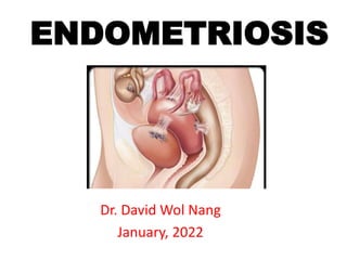 ENDOMETRIOSIS
Dr. David Wol Nang
January, 2022
 