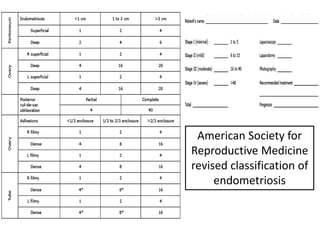 American Society for
Reproductive Medicine
revised classification of
endometriosis
 