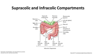 Supracolic and Infracolic Compartments
http://y7177.com/sa/anato/peritoneum/index.htm
 