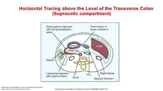 Horizontal Tracing above the Level of the Transverse Colon
(Supracolic compartment)
https://www.jaypeedigital.com/eReader/chapter/9788180617348/ch132
 