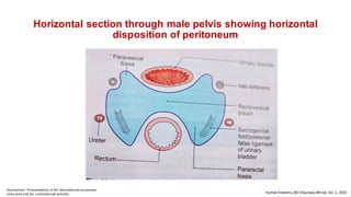 Horizontal section through male pelvis showing horizontal
disposition of peritoneum
 