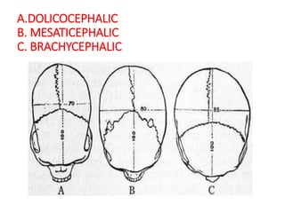 Dolichocephalic Races DETERMINATION OF RACE FROM HUMAN REMAINS.pptx Dr. Haricharan MD RIMS ...