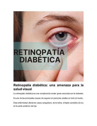 Retinopatía diabética: una amenaza para la
salud visual
La retinopatía diabética es una complicación ocular grave asociada con la diabetes.
Es una de las principales causas de ceguera en personas adultas en todo el mundo.
Esta enfermedad afecta los vasos sanguíneos de la retina, el tejido sensible a la luz
en la parte posterior del ojo.
 