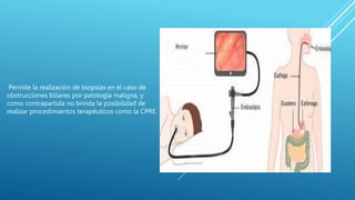 Permite la realización de biopsias en el caso de
obstrucciones biliares por patología maligna, y
como contrapartida no brinda la posibilidad de
realizar procedimientos terapéuticos como la CPRE.
 