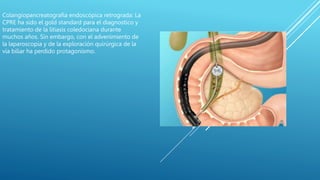 Colangiopancreatografia endoscópica retrograda: La
CPRE ha sido el gold standard para el diagnostico y
tratamiento de la litiasis coledociana durante
muchos años. Sin embargo, con el advenimiento de
la laparoscopia y de la exploración quirúrgica de la
vía biliar ha perdido protagonismo.
 