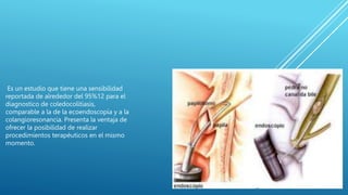 Es un estudio que tiene una sensibilidad
reportada de alrededor del 95%12 para el
diagnostico de coledocolitiasis,
comparable a la de la ecoendoscopía y a la
colangioresonancia. Presenta la ventaja de
ofrecer la posibilidad de realizar
procedimientos terapéuticos en el mismo
momento.
 