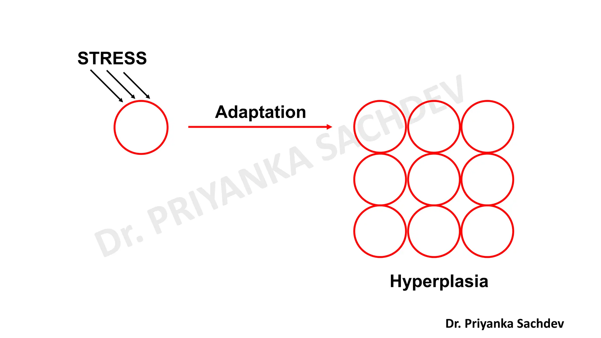 General Pathology pdf By Miss Priyanka Sachdev PDF General Pathology Pdf By Miss Priyanka Sachdev Pdf
