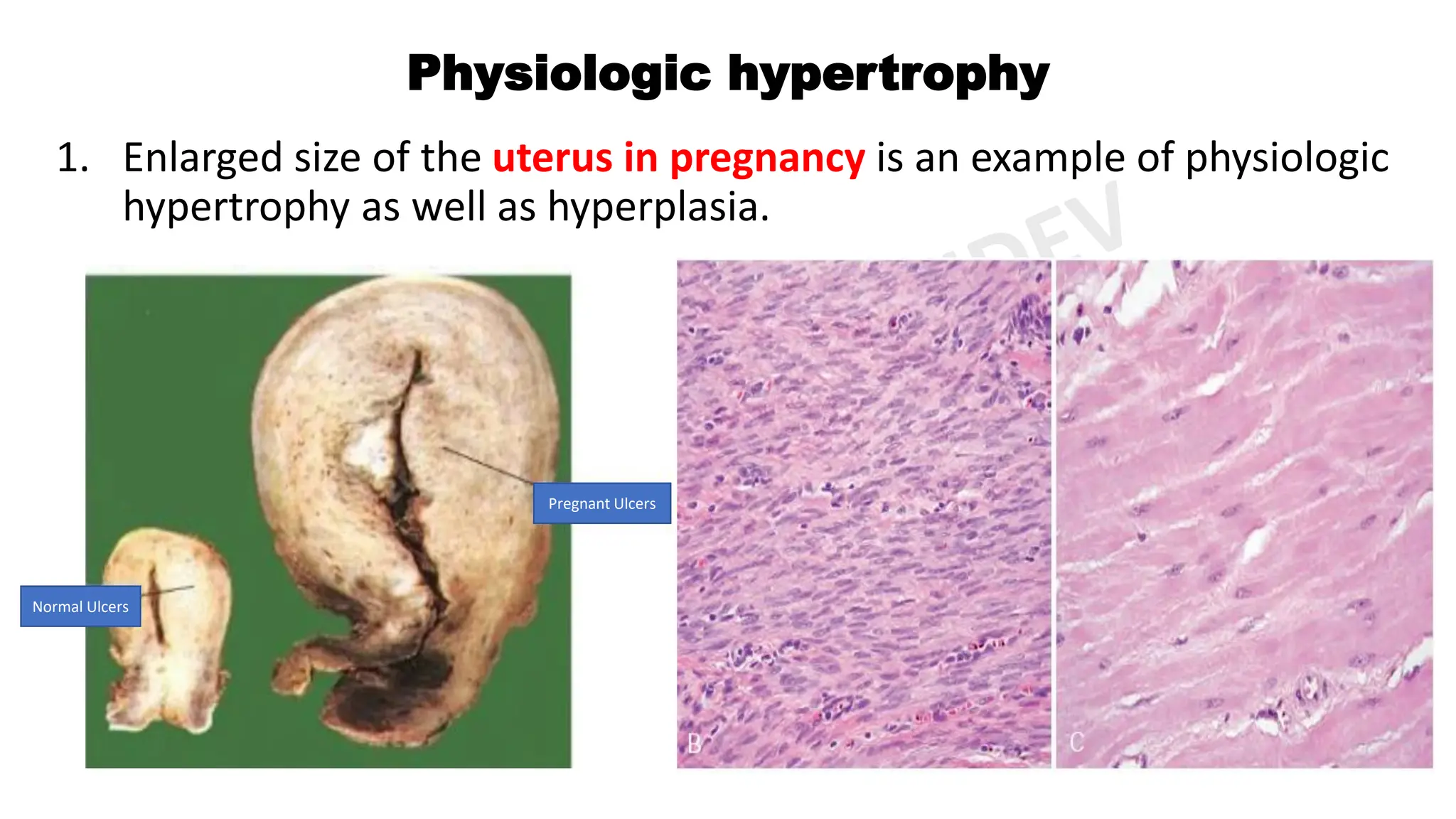General Pathology pdf By Miss Priyanka Sachdev PDF General Pathology Pdf By Miss Priyanka Sachdev Pdf