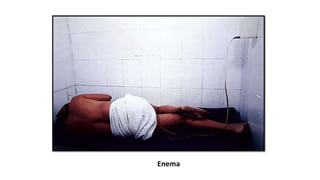 Enema
 