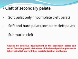 Dr. Saad Gasgus cleft lip and palate-1 (Muhadharaty).ppt