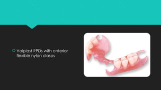 diagnosis and treatment planning of removable partial dentures | PPTX