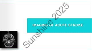 The Role of Neuroimaging in Acute Stroke | PDF