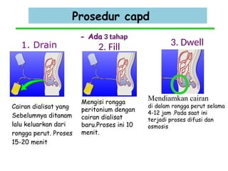 PRINSIP-PRINSIP CAPD pada pasien GGK.pptx