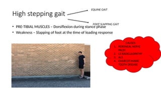 different types of Gait in orthopaedic injuries | PPTX