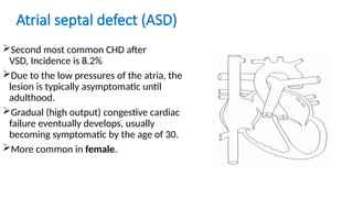 Vsd Incedence Dr. Sanjida Khan-1 for radiology residents.pptx