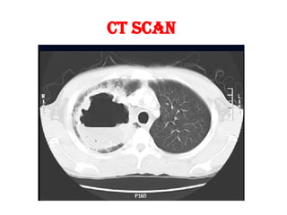 CT SCAN
 