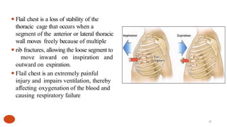 Outward Ribs Dr ariho Clinical detail Anat thorax.pptx