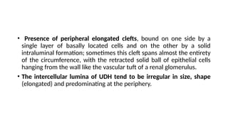 Comprehensive Overview of Benign Breast Disease Pathology and Diagnosis ...