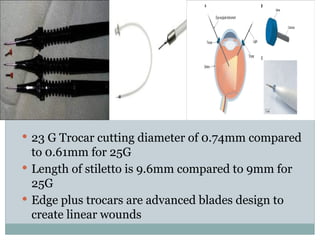 Advancements and Techniques in Micro Incision Vitrectomy Surgery (MIVS ...