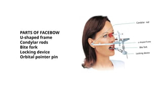 Condylar Rods Comprehensive Guide to Occlusal Registration, Face-Bows, and ...