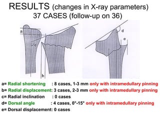 Percutaneous pinning of distal radius (old technique) | PDF