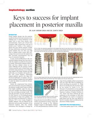 Dental Practice // March-April 2013 // Vol 11 No 500
Keys to success for implant
placement in posterior maxilla
implantology section
INTRODUCTION
Dental implant therapy into the posterior
maxilla has always been and continues to be a
challenge due to various limitations in this
region such as poor bone density, sinus
pneumatization, lateral and vertical bone
resorption, high occlusal forces and area of
limited access. Further, if the implant is
placed into poor density posterior maxilla,
the bone which forms around the osseointe-
grated implants does not show very high
bone to implant surface contact (BIC) per-
centage, thus in several cases the implant even
after successful osseointegration may fail
once it is restored in function.
In past, several modifications to the con-
ventional implant therapy have been done to
make the implant successful into the posteri-
or maxilla. Achieving the adequate initial sta-
bility and bone implant contact are two
major challenges into the posterior maxilla.
Various protocols such as lateral bone aug-
mentation using osteotomes, use of wide and
long implant with deeper threads and high
pitch value, use of implant with specific sur-
face (HA coated implant), submerging
implant platform apical to the ridge crest,
bicortical stabilization of implant, and pro-
gressive loading of implant have been applied
to make the implant successful into the pos-
terior maxilla.
Besides the compromised bone density,
sinus pneumatization is the great challenge in
the posterior maxilla which results in limited
bone height availability under the sinus. In
such cases, maxillary sinus lifting and grafting
has been providing promising results. The
sinus-lift procedure was first performed by
Dr. Hilt Tatum Jr. in 1974 during his period
of preparation to begin sinus grafting. The
first sinus graft was performed by Tatum in
February, 1975 in Lee County Hospital in
Opelika, Alabama. This was followed by the
placement and successful restoration of two
Endosteal implants. After this, suitable
instruments were developed to manage the
lining elevation from the different anatomical
surfaces encountered in sinuses. Tatum first
presented the concept at The Alabama
Implant Congress in Birmingham, Alabama
in 1976 and presented the evolution of tech-
nique during multiple podium presentations
each year until 1986 when he published an
article describing the procedure. Dr. Philip
Boyne was introduced to the procedure when
he was invited, by Tatum, to be "The
Discusser" of a presentation on sinus grafting
given by Tatum at the annual meeting of The
American Academy of Implant Dentistry in
1977. Boyne and James authored the first
publication on the technique in 1980 when
they published case reports of autogenous
grafts placed into the sinus and allowed to
heal for 6 months, which was followed by the
placement of blade implants.
LIMITATIONS WITH POSTERIOR MAXILLA
1. Poor bone quality (type IV/ D4) - challenge
FIG 3 & 6: Dental implant with sharp and self tapping threads at the apical third and self condensing body can be
placed after minimal drilling and achieves high initial stability even into poor density bone.
FIG 7 & 8: Set of osteotomes which are used for lateral
bone condensation and sub-crestal sinus elevation.
FIG 1 & 2: After the osteotomy preparation for the implant 2mm short of sinus floor, the rest of the sinus floor is
either grinded up using diamond tips/burs or fractured up using osteotome and the implant is placed by stabilis-
ing its apex into the sinus floor and collar into the crest (Bicortical stabilization)
DR. AJAY VIKRAM SINGH AND DR. SUNITA SINGH
 