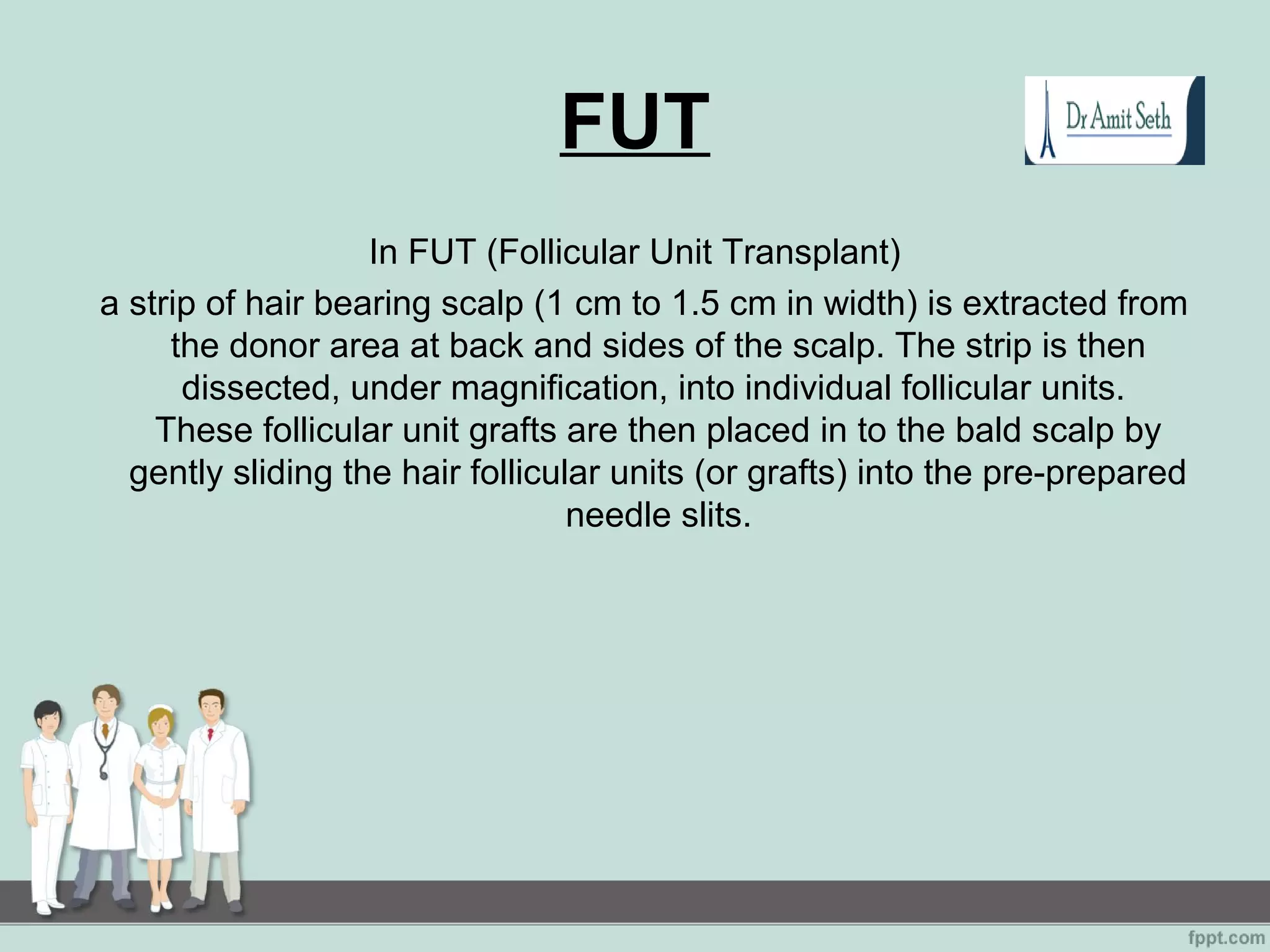 FUT
In FUT (Follicular Unit Transplant)
a strip of hair bearing scalp (1 cm to 1.5 cm in width) is extracted from
the donor area at back and sides of the scalp. The strip is then
dissected, under magnification, into individual follicular units.
These follicular unit grafts are then placed in to the bald scalp by
gently sliding the hair follicular units (or grafts) into the pre-prepared
needle slits.
 