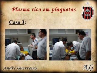 Plasma rico em plaquetas Caso 3 : 