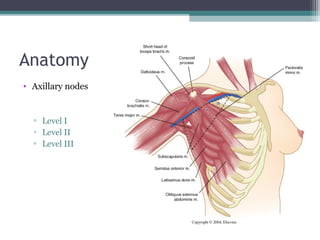 Anatomy
• Axillary nodes


  ▫ Level I
  ▫ Level II
  ▫ Level III
 