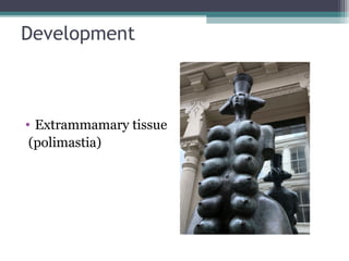 Development



• Extrammamary tissue
 (polimastia)
 