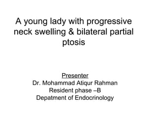 A young lady with progressive
neck swelling & bilateral partial
ptosis
Presenter
Dr. Mohammad Atiqur Rahman
Resident phase –B
Depatment of Endocrinology
 