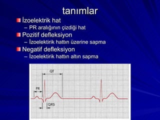 tanımlar İzoelektrik hat PR aralığının çizdiği hat Pozitif defleksiyon İzoelektirik hattın üzerine sapma Negatif defleksiyon İzoelektirik hattın altın sapma 