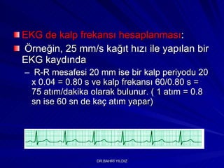 EKG de kalp frekansı hesaplanması :  Örneğin, 25 mm/s kağıt hızı ile yapılan bir EKG kaydında  R-R mesafesi 20 mm ise bir kalp periyodu 20 x 0.04 = 0.80 s ve kalp frekansı 60/0.80 s = 75 atım/dakika olarak bulunur.  ( 1 atım = 0.8 sn ise 60 sn de kaç atım yapar) 