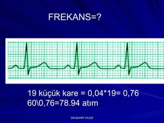 FREKANS=? 19 küçük kare = 0,04*19= 0,76 60\0,76=78.94 atım 