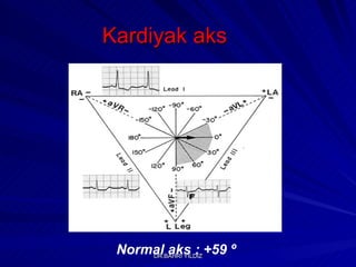 Normal aks : +59  º Kardiyak aks 