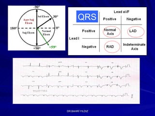 QRS 