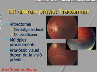 DR cirurgia prèvia: Tractament Vitrectomia Cerclatge escleral Oli de silicona Múltiples procediments Pronòstic visual depen de la visió prèvia 