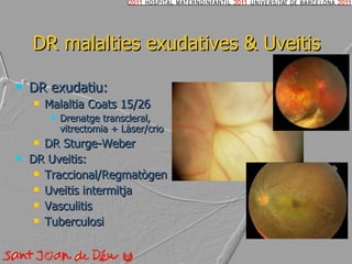 DR malalties exudatives & Uveitis DR exudatiu: Malaltia Coats 15/26 Drenatge transcleral, vitrectomia + Làser/crio DR Sturge-Weber DR Uveitis: Traccional/Regmatògen Uveitis intermitja Vasculitis Tuberculosi 