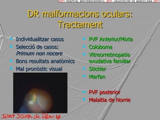 DR malformacions oculars: Tractament Individualitzar casos Selecció de casos:  Primum non nocere Bons resultats anatòmics Mal pronòstic visual PVF Anterior/Mixta Coloboma Vitreorretinopatia exudativa familiar Stickler Marfan PVF posterior Malaltia de Norrie 