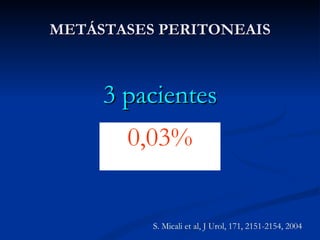 METÁSTASES PERITONEAIS 3 pacientes 0,03% S. Micali et al, J Urol, 171, 2151-2154, 2004 