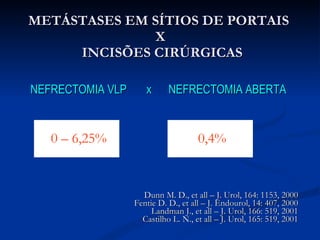 METÁSTASES EM SÍTIOS DE PORTAIS  X  INCISÕES CIRÚRGICAS NEFRECTOMIA VLP  x  NEFRECTOMIA ABERTA   0 – 6,25% 0,4% Dunn M. D., et all – J. Urol, 164: 1153, 2000 Fentie D. D., et all – J. Endourol, 14: 407, 2000 Landman J., et all – J. Urol, 166: 519, 2001 Castilho L. N., et all – J. Urol, 165: 519, 2001 