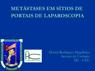 METÁSTASES EM SÍTIOS DE  PORTAIS DE LAPAROSCOPIA Daniel Rodrigues Magalhães Serviço de Urologia HC - UFG 