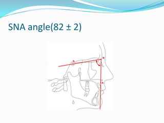 SNA angle(82 ± 2)
 
