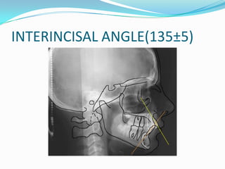 INTERINCISAL ANGLE(135±5)
 