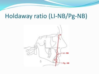 Holdaway ratio (LI-NB/Pg-NB)
 