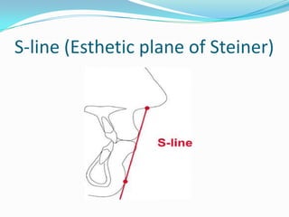 S-line (Esthetic plane of Steiner)
 